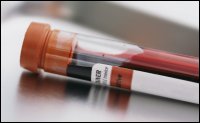 Blood sample in vial for testing.